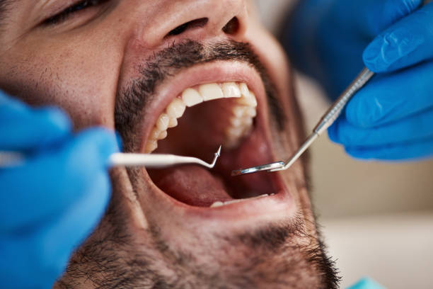 Best Emergency Cosmetic Dentistry (e.g., broken veneers) in Metairie, LA