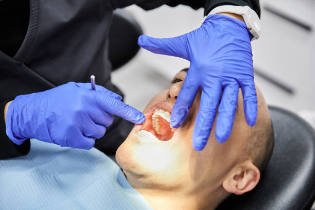 Best Emergency Root Canal Therapy in Metairie, LA